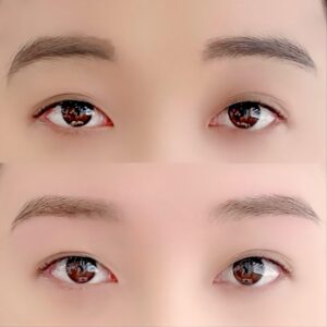 眉毛の施術イメージ