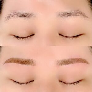 眉毛の施術イメージ