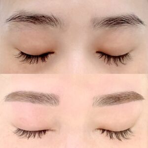 眉毛の施術イメージ