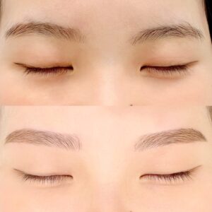 眉毛の施術イメージ