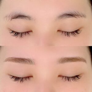 眉毛の施術イメージ
