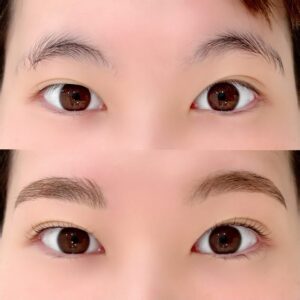 眉毛の施術イメージ