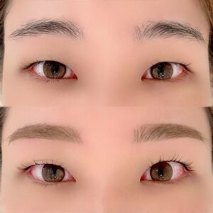眉毛の施術イメージ