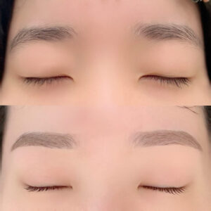 眉毛の施術イメージ