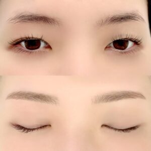 眉毛の施術イメージ