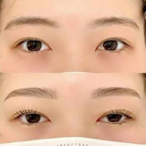 眉毛の施術イメージ