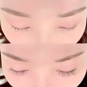 眉毛の施術イメージ