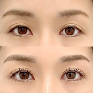 眉毛の施術イメージ