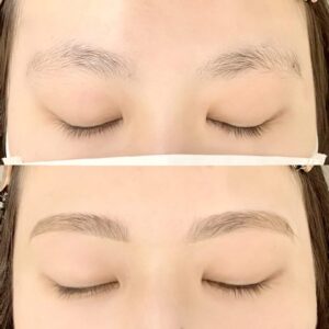 眉毛の施術イメージ